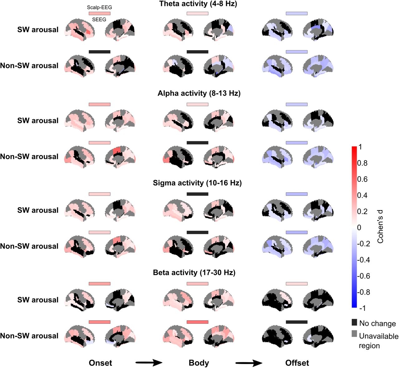 Intracerebral Dynamics Of Sleep Arousals A Combined Scalp Intracranial EEG Study Journal Of Neuroscience Intracerebral Dynamics Of Sleep Arousals A Combined Scalp Intracranial EEG Study Journal Of Neuroscience